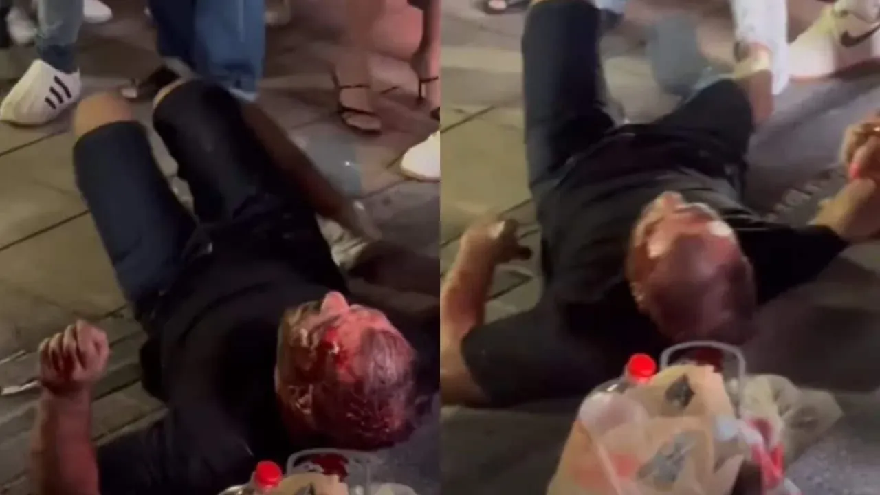 목격자들의 보복으로 부상당한 외국인