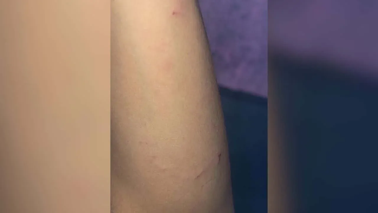 폴란드 고객으로부터 폭행당한 트랜스젠더 피해자