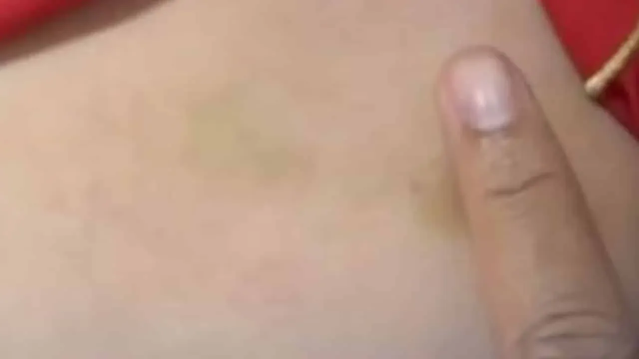 학대로 부상을 입은 아동의 모습