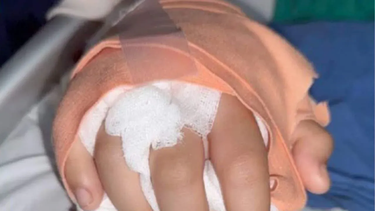 치앙마이 10대 소녀 손 재접합 수술