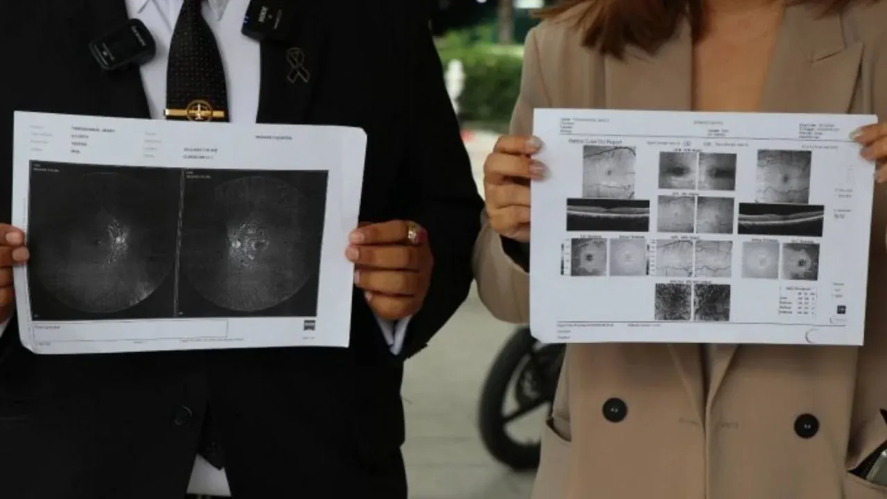 테니스공 공격 관련 보도