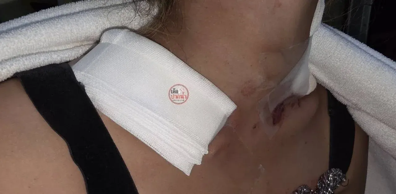 태국 가정폭력 사건 현장