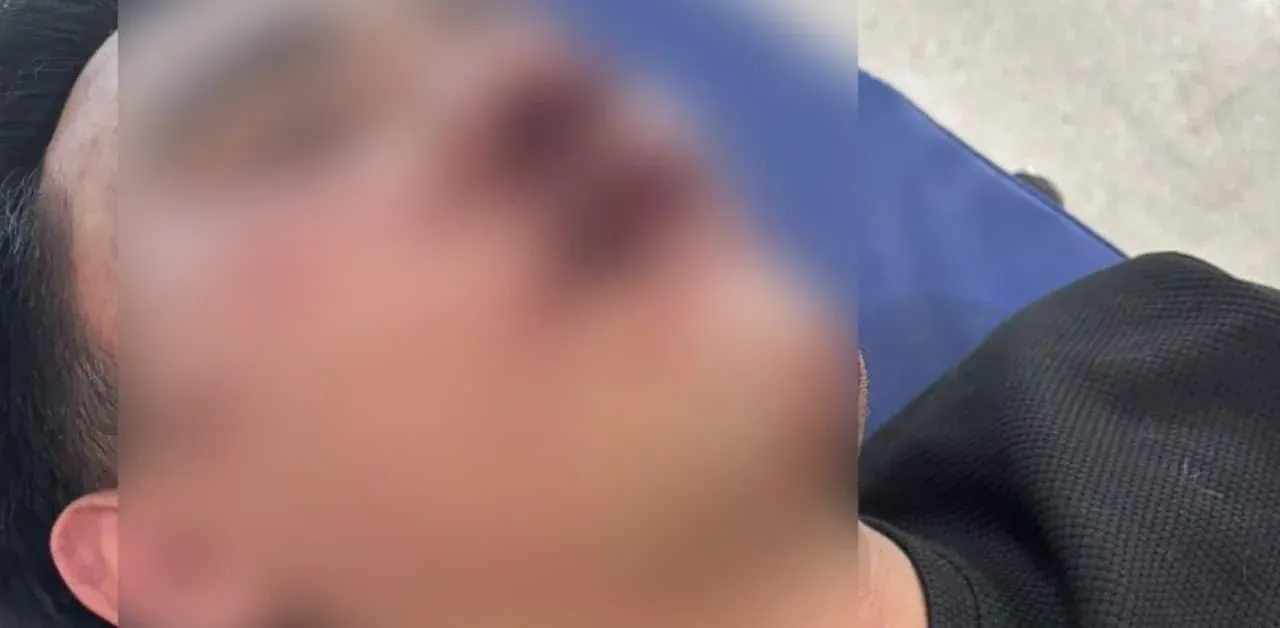 파타야 바 사건 피해자