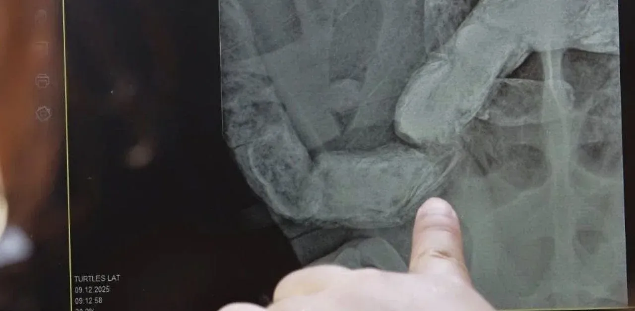 치료 중인 바다거북