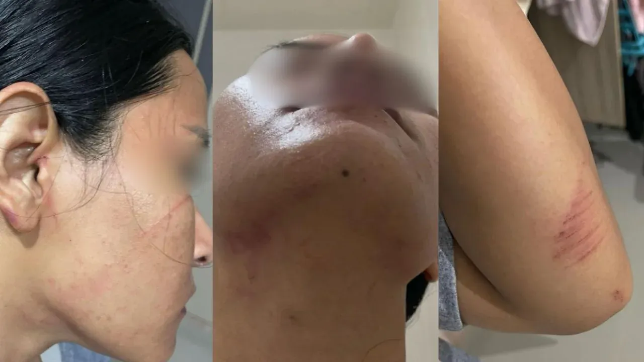 방콕 택시 기사가 성폭행 시도에서 구조됨