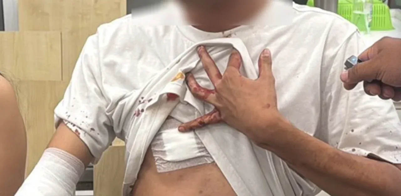 부상당한 보안요원 티티삭