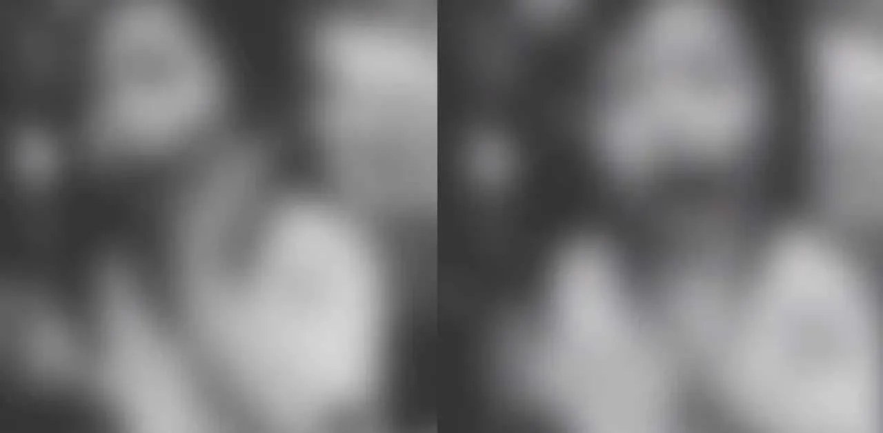 학대당한 태국 소녀