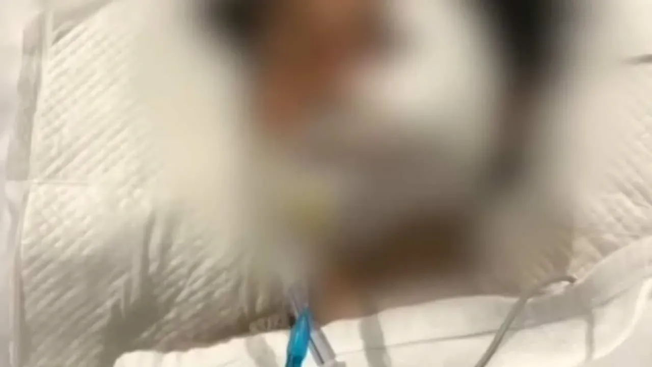 병원 의료 부실 관련 추가 보도 화면