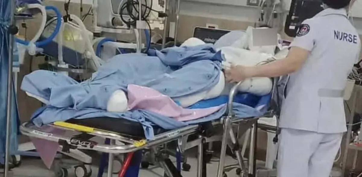 태국 초등학생, 교사 도우려다 말벌집 제거 작업 중 전신 화상