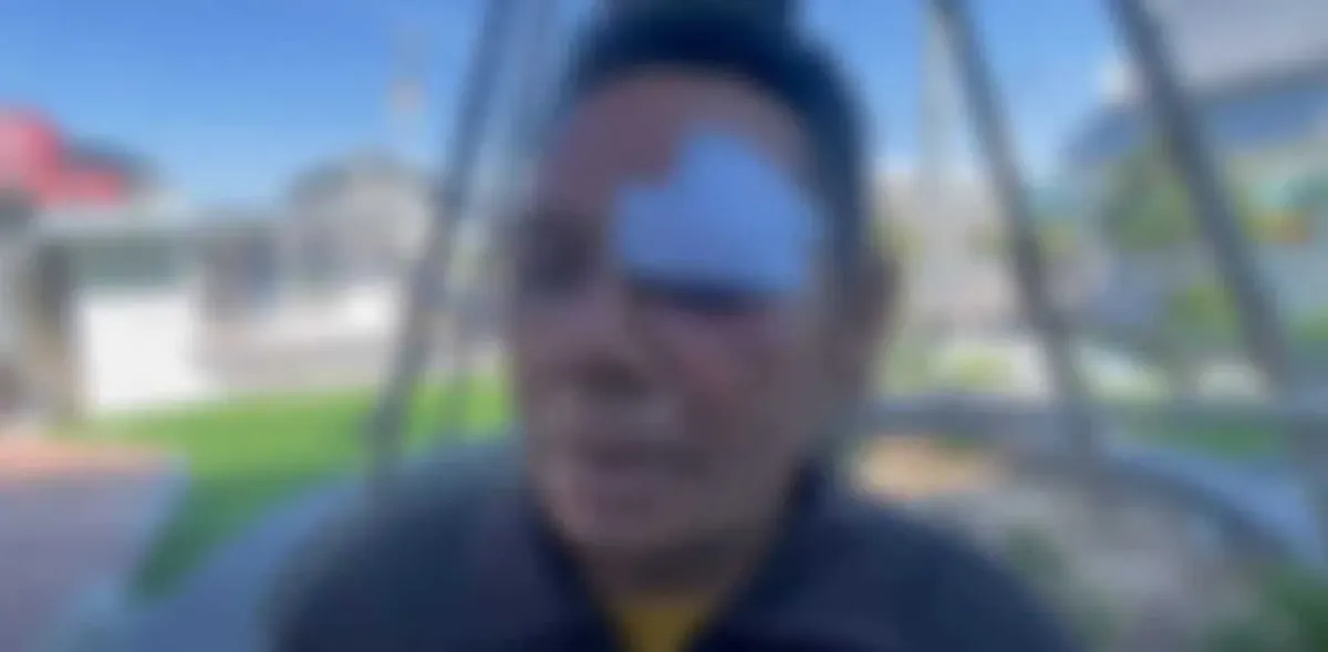 파타야 나이트클럽 경비원들, 인도인 의뢰로 택시기사 폭행 사건