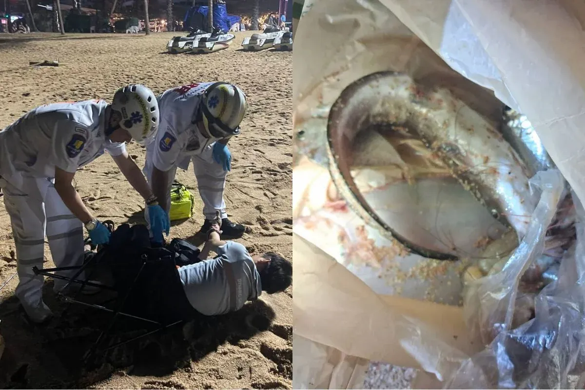 태국 좀티엔 해변서 독성 메기에 쏘여 마비 증상 발생