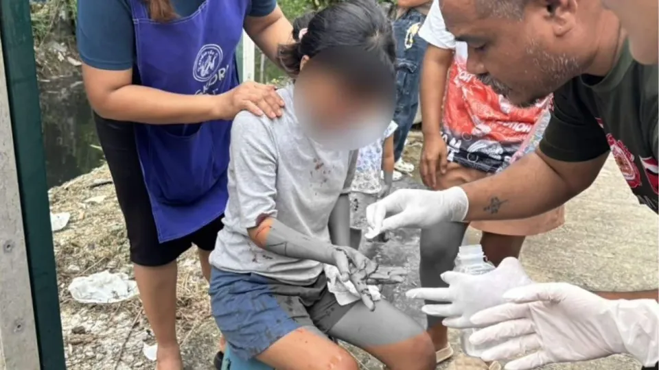 태국 아버지, 딸 도움 거부에 격분해 톱으로 공격