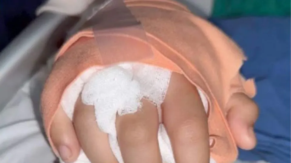 치앙마이 10대 소녀, 갱단 공격 후 절단된 손 재접합 수술 성공