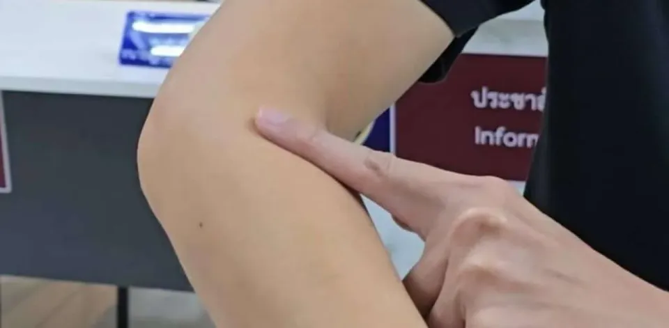 태국 남성, MRT 전철에서 팔에 피 묻은 채 발견돼 경각심 높여