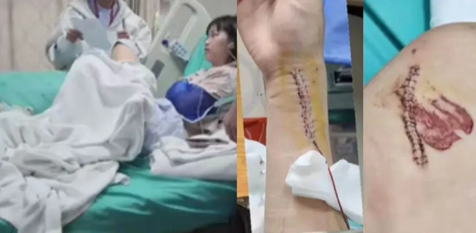 치앙라이 교통사고 외국인 학생, SNS로 정의 실현 나서