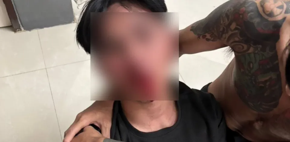 "싱글이라고 했는데": 파타야 남성, 거짓말로 폭행당하고 절도 누명까지