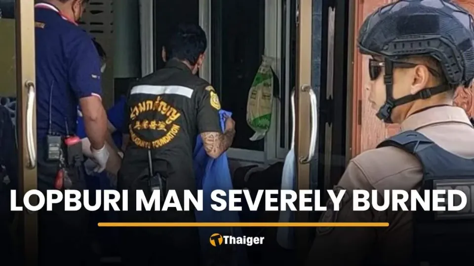 롭부리 남성, 2시간 실종 후 심각한 화상으로 발견